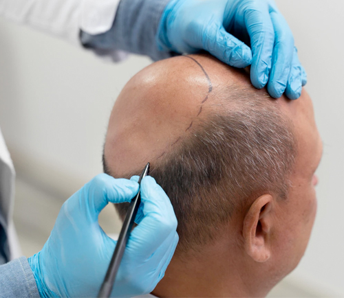 Natural Hair Treatment Near Kalavad Road